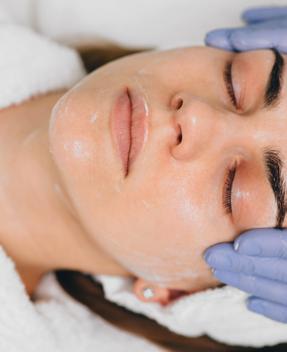 Woman-undergoing-radiofrequency-microneedling-treatment