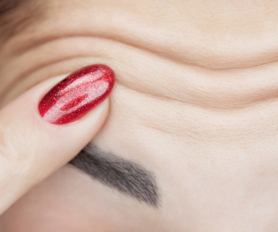 A-woman-shows-deep-wrinkles-on-her-forehead