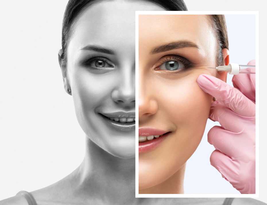 Beautiful-woman-face-showing-anti-wrinkle-injections